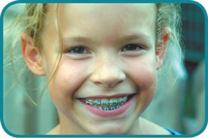 Why early orthodontic treatment? - Knoxville TN Magazines